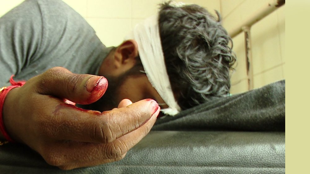 ABVP Student Attacked by SFI Workers